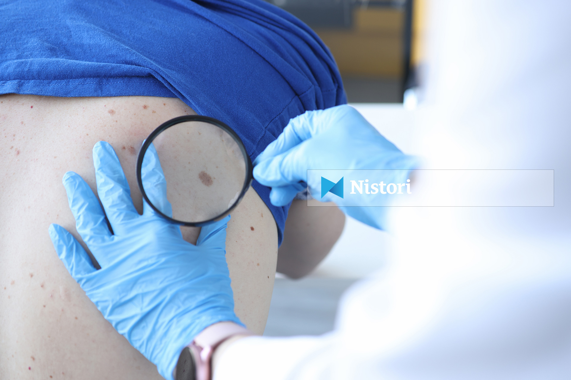 rritje-alarmante-e-kancerit-te-lekures-ne-rmv-mungojne-terapite-ne-onkologji