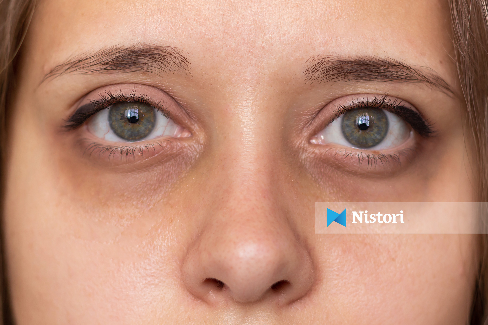 keto-ndryshime-ne-trupin-tuaj-tregojne-mungese-te-vitaminave