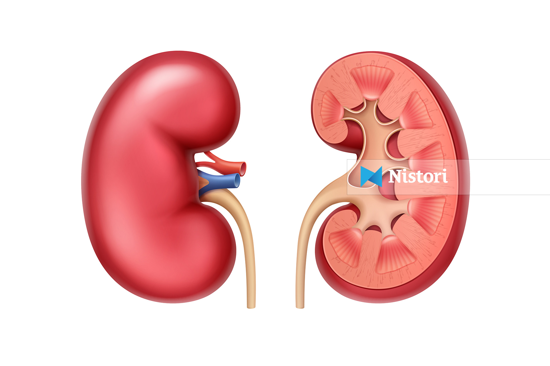 Pse krijohen kalcifikimet dhe në cilat pjesë të trupit shfaqen më shpesh
